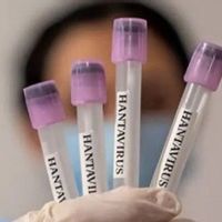 Seorang Warga Jawa Timur Positif Hantavirus sejak Januari 2026