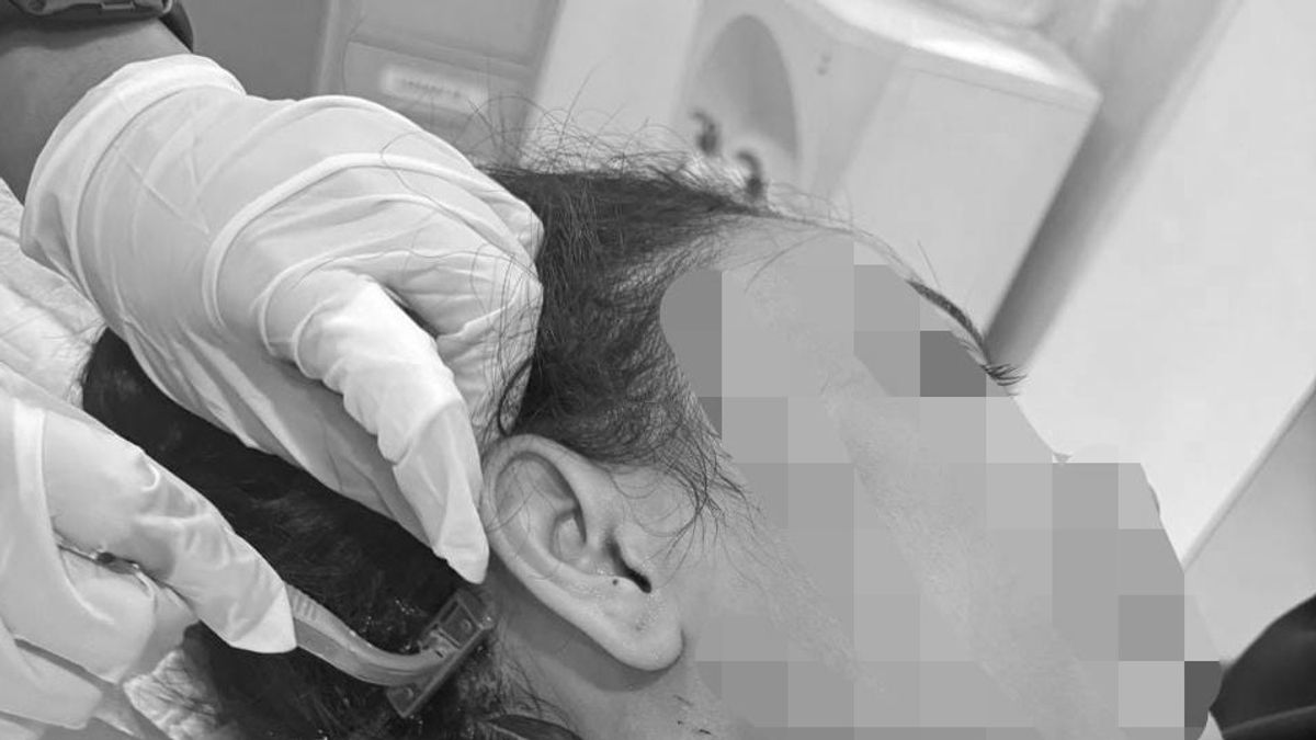 Ngeri! Le vol de Sadis dans Tanah Abang Tandie une femme par derrière, son cou en attente