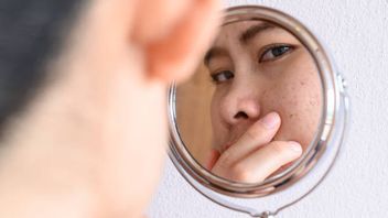 Be Careful, These 3 Products Can Make Black Spots Worse