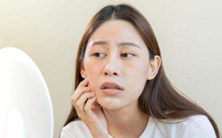 Bahan Aktif dalam Skincare yang Bikin Kulit Sensitif Terhadap Paparan Sinar Matahari