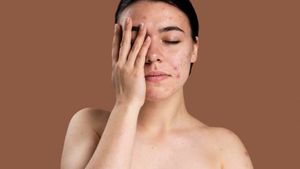 Obat Cacar Air Tradisional Paling Ampuh: dari Daun Cangkring hingga Baking Soda
