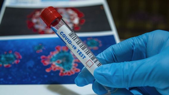 BPPT Siapkan Perangkat Tes Antigen dan Antibodi