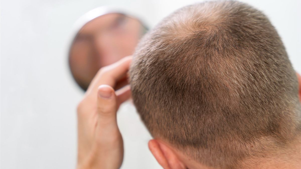 Masturbasi Bisa Bikin Botak, Benarkah Mitos Tersebut? Berikut penelitiannya