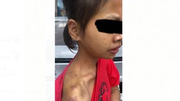 Polisi Malaysia Tahan 2 Perempuan Pelaku Penganiayaan ART Indonesia: Rotan, Besi dan Kayu Turut Disita
