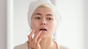 Mengenal Penyebab dan Cara Mencegah Jerawat Bibir