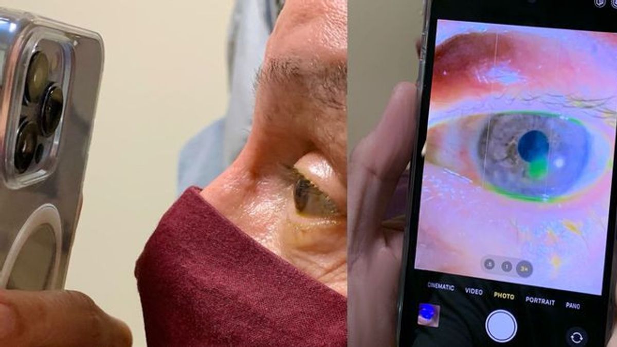 驚かないでください!眼科医は、患者の目を調べるためにiPhone 13を使用しています