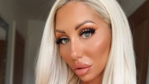 Istri Ingin Seperti Barbie, Suami Gelontorkan Rp318 Juta untuk Operasi Plastik 