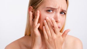 3 Perbedaan Kulit Kering dan Kulit Dehidrasi: Penyebab, Ciri-Ciri dan Cara Mengatasinya 