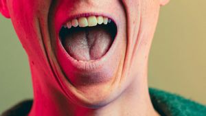 Waspadai Tanda-Tanda Diabetes Bisa Terlihat dari Kondisi Mulut