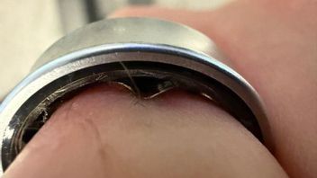 Baterai Samsung Galaxy Ring Bengkak, Sebabkan Pengguna Masuk UGD