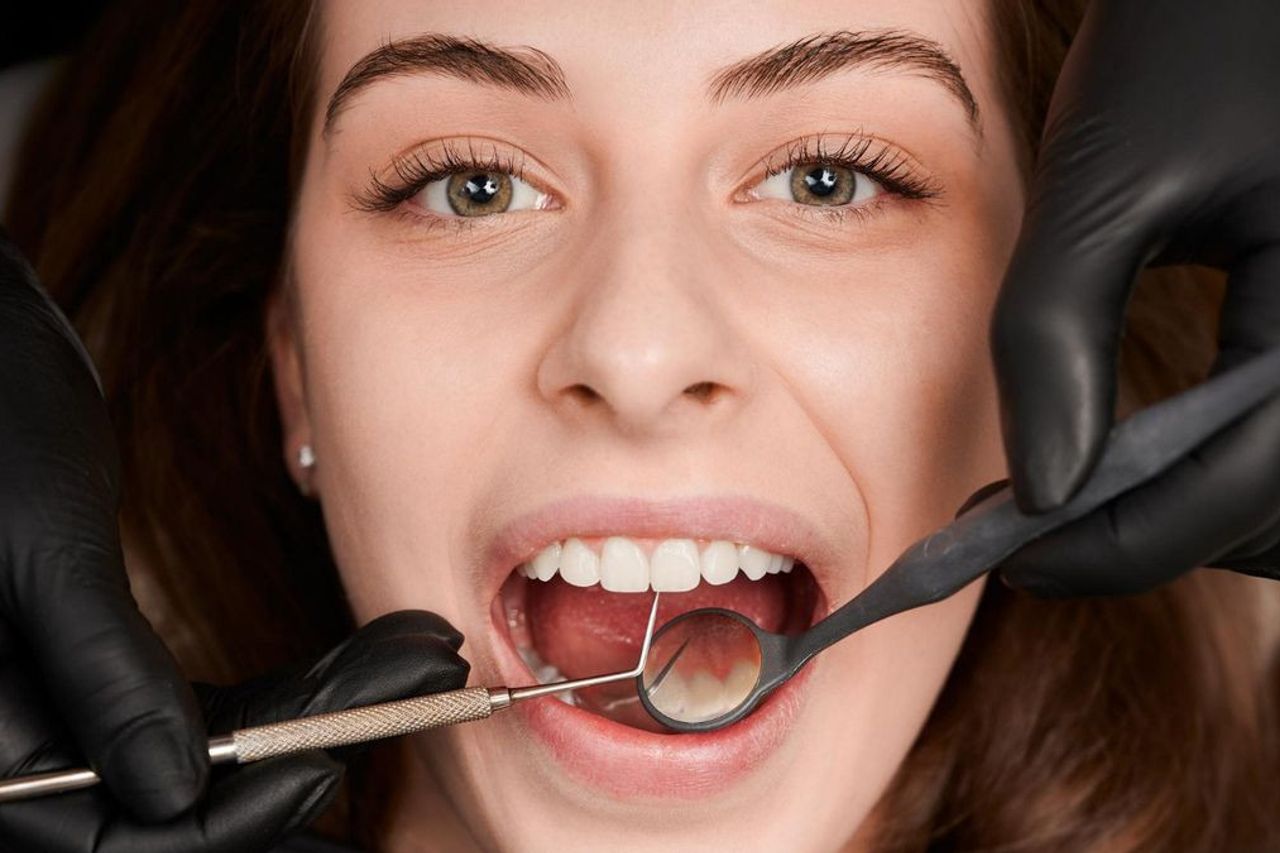 How To Care For Descent Teeth So As Not To Spread