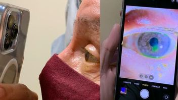 驚かないでください!眼科医は、患者の目を調べるためにiPhone 13を使用しています
