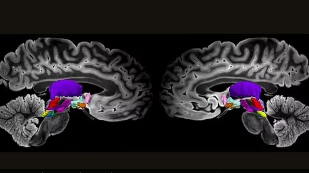 新しい発見:意識に役割を果たす脳内の主要な神経系の同定