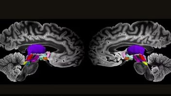 새로운 발견: 의식에서 역할을 하는 뇌의 주요 신경망 식별