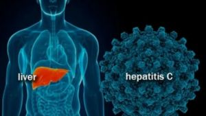 Kemenkes: Sudah Ada 14 Kasus Diduga Hepatitis Akut di Indonesia