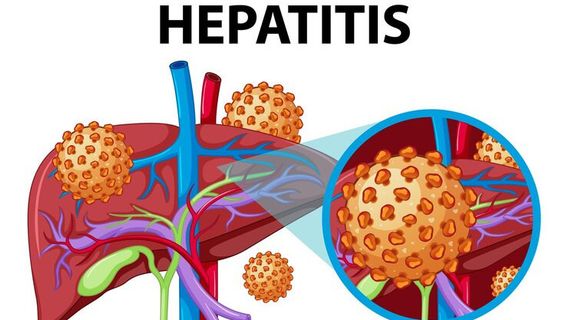 Gejala Hepatitis Misterius dan Penyebabnya yang Membingungkan para Peneliti