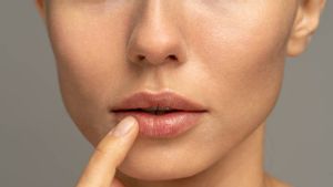 3 Tips For Caring For Dry Lip Balm Lips