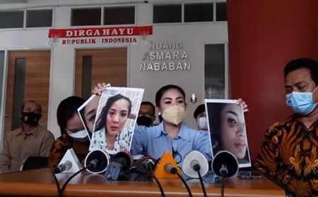 Alami KDRT Dijambak, Dipukul, Bahkan Diselingkuhi, Ini Alasan Nindy Ayunda Bertahan 10 Tahun