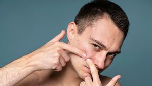 Tumbuh Jerawat di Pipi karena Makan Apa? Ini Penyebab dan Rekomendasi Dermatolog