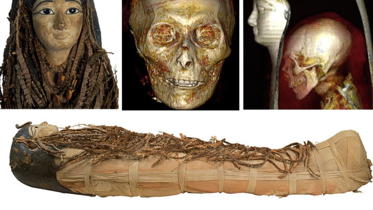 Through Digital Technology Scientist Amenhotep I Mummy Surgery, Without Damage To Masks And Bandages