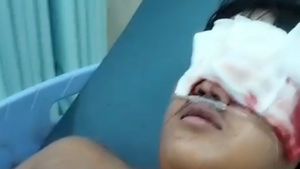 Pecah Tawuran Antarwarga di Kampung Bahari Tanjung Priok, Jari Tangan Remaja Ini Nyaris Putus 