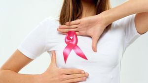 Alasan Mengapa Wanita Harus Deteksi Kanker Payudara Sejak Dini