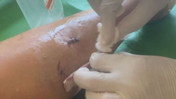 assis sur une moto en attendant des enfants, les personnes âgées à Tanjungpinang ont été attaquées par des chiens sauvages