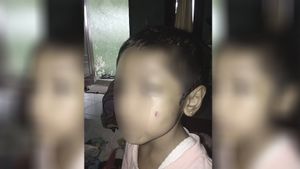 Gara-gara Makanan, Bocah 5 Tahun Dianiaya Ibu Tiri, Ayah Korban Lapor Polisi 