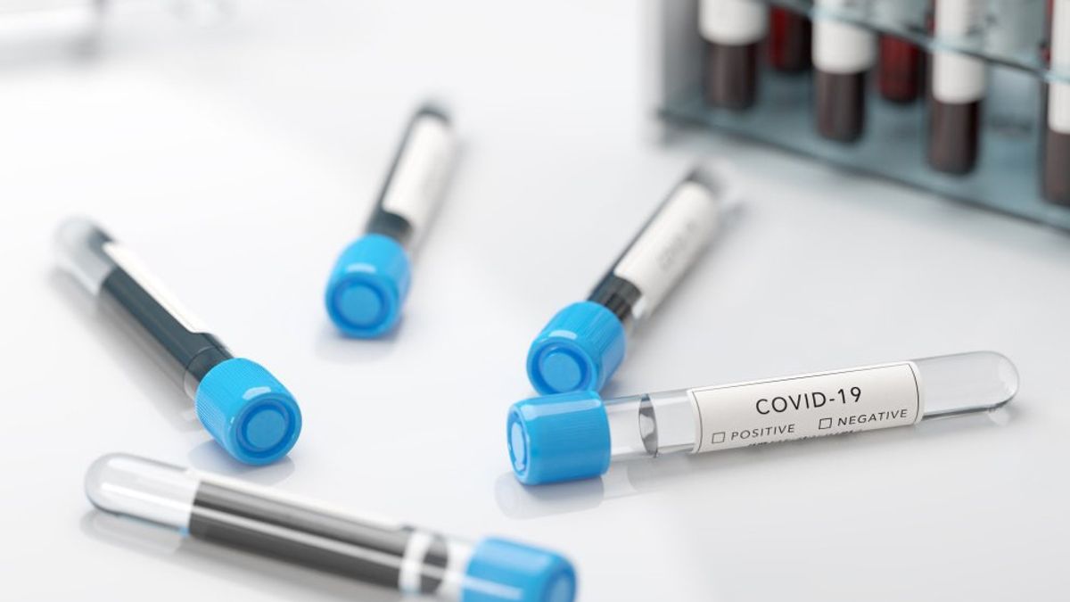 Circular Minimum Price For COVID-19 Swab Test Not Yet Out, Are You Ready To Follow The Hospital?