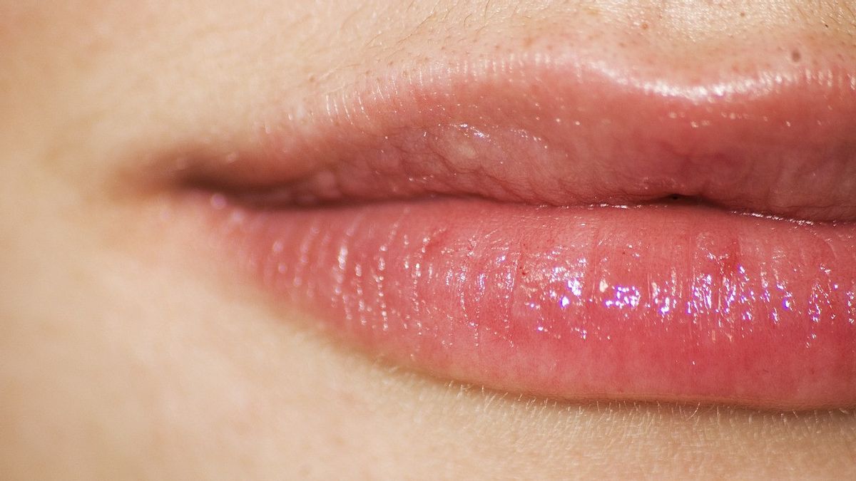 The Commotion Of The Top Right Lip Is Not Melu Related To The Javanese Primbon, Here Are 5 Causes Medically