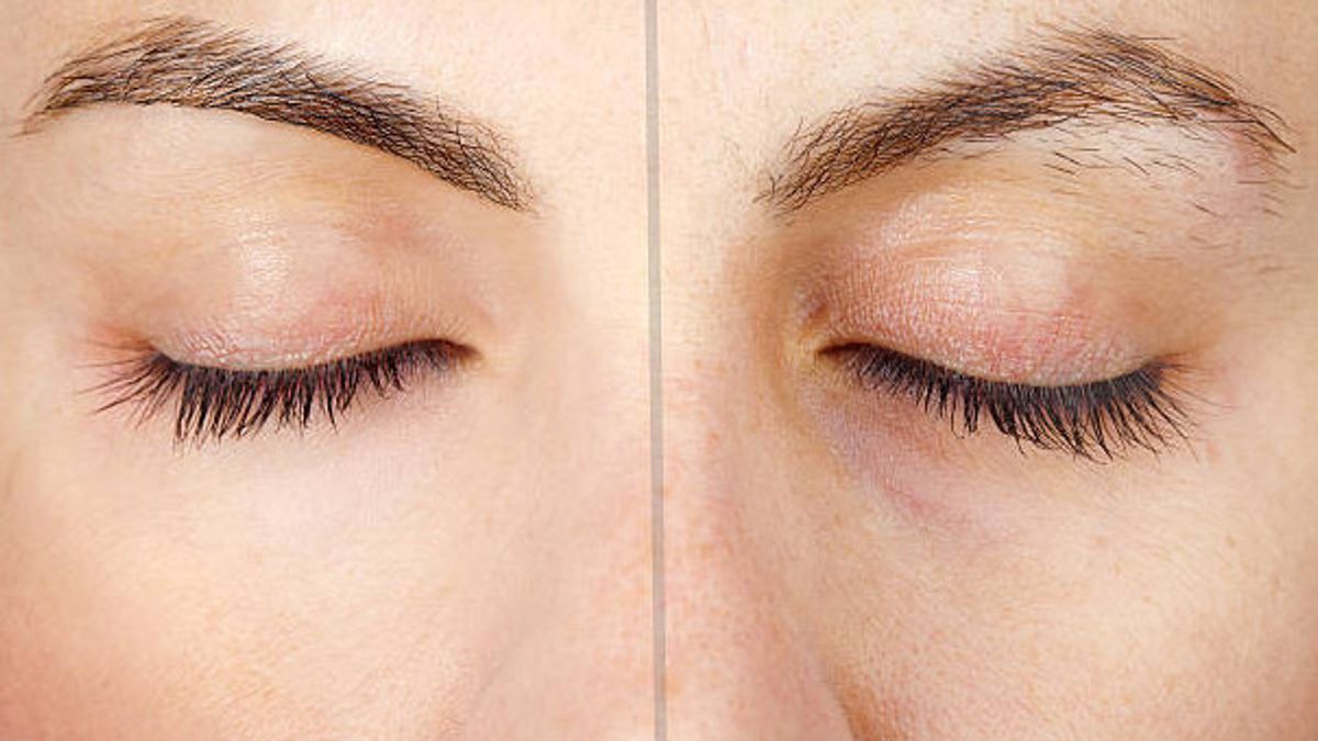 Want To Have A Smoother Skin? Check Out 6 Tips To Eliminate Crepey Skin