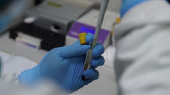 COVID-19 Tak Bisa Dicap Penyakit Endemik Seperti HIV