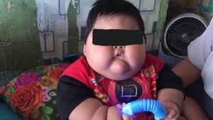 Menkes Minta Balita 16 Bulan Obesitas di Bekasi Dirawat: Harus Di-cover BPJS