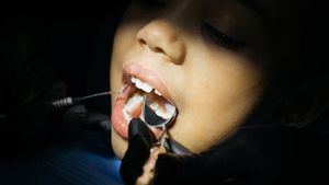 Waspada, Ini Tanda Gusi Mengalami Peradangan yang Harus Segera Diatasi