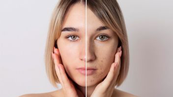 男性和女性的自然面部皮肤的pH值是什么,程度如何