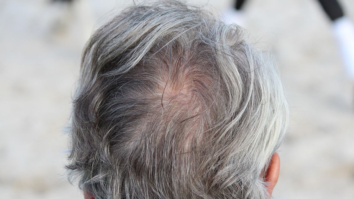 12 Warna Rambut untuk Menutupi Uban, Cek Rekomendasinya di Sini 