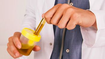 rénage au cancer testé par urine montre de nouveaux espoirs pour la détection précoce non invasive