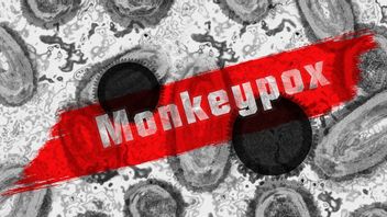病例数量正在下降和放缓，世卫组织认为猴痘可以在欧洲消除