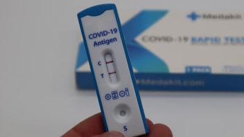 Mise à Jour Des Cas COVID-19 Au 21 Janvier : Nouveaux Cas 11 703, Guéris Augmentés De 9 087   