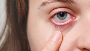 Normalkah Kondisi Mata Sering Berkedut? Ini Penjelasan Dokter