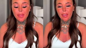 Tanning Experiment Ends In Disaster, Influencer's Face Experiences Serious Wounds