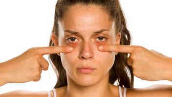 rénal 3 causes d’éruptions sous les yeux qui sont souvent négligées