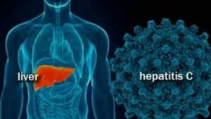 Kemenkes: Separuh dari 35 Laporan Tidak Terbukti Hepatitis Misterius