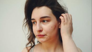 The Right Skincare Choice for Oily Skin, Effective in Preventing Acne