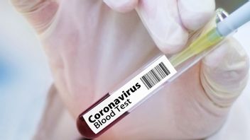 Il Faut Savoir Qu’il Faudra Beaucoup De Temps Pour Que Le Vaccin COVID-19 Soit Vendu Au Public