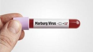 Belum Ada Obat dan Vaksin Virus Marburg, Kemenkes Ingatkan Masyarakat Waspada