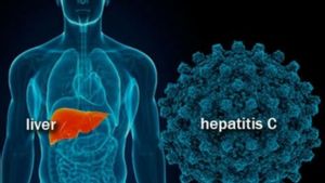 Epidemiolog Sebut Penyebaran Hepatitis Akut di Indonesia Lebih Rawan, Kenapa?