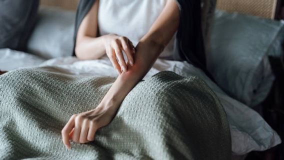 9 Tips Merawat Kulit dengan Psoriasis, Salah Satunya Rajin Gunakan Pelembab 