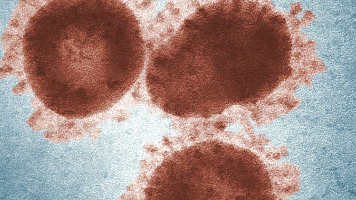ガーナ、エボラに似たコウモリ媒介性マールブルグウイルスの放出を宣言