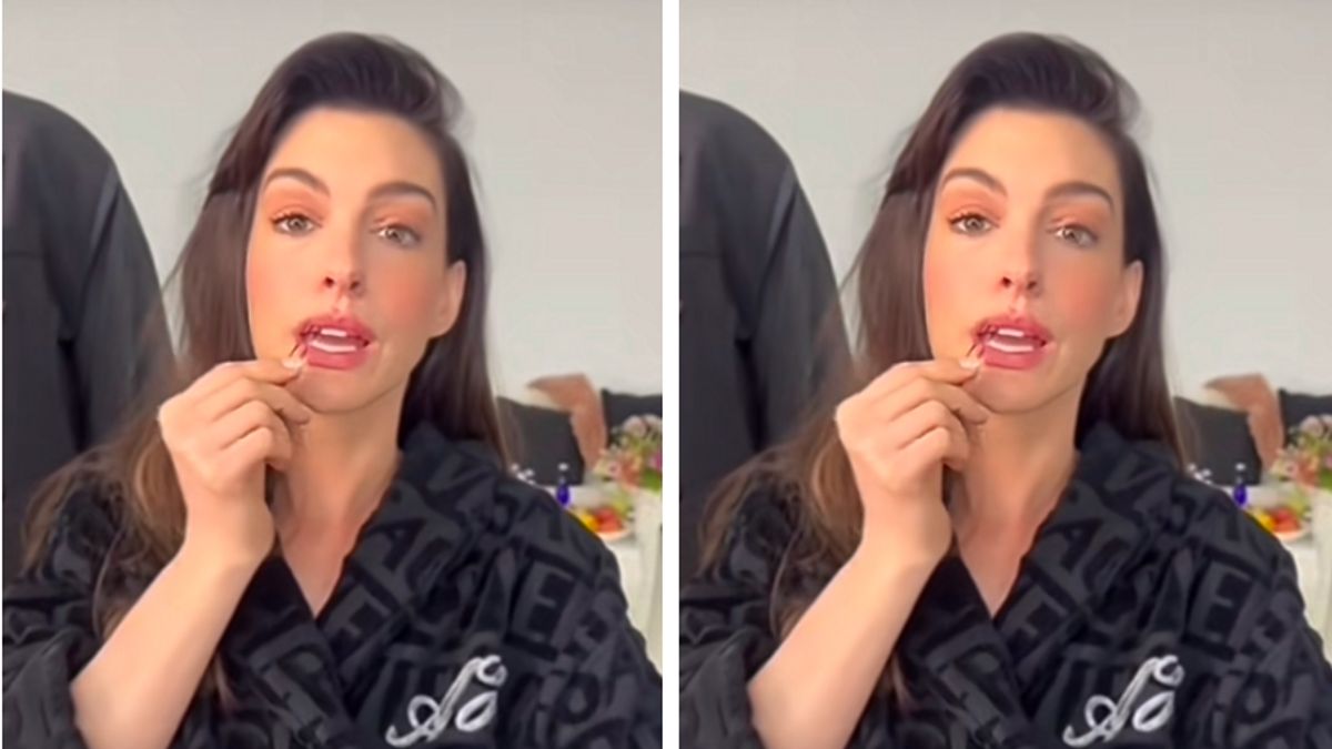 Cara Nyeleneh Anne Hathaway Bikin Tampilan Bibir Tampak Lebih Seksi, Cuma Pakai Jepitan Rambut!